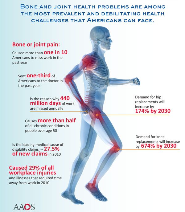 Causes Of Joint Pain And Foods That Relieve Joint Pain Fitneass