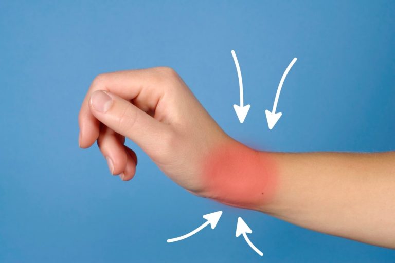 Tips For Reducing Pain When A Wrist Injury Occurs - Fitneass