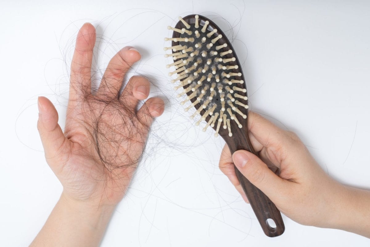 Hair Regrowth Solutions To Avoid A Hair Transplant - Fitneass